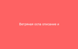 Ветряная оспа описание и симптомы болезни