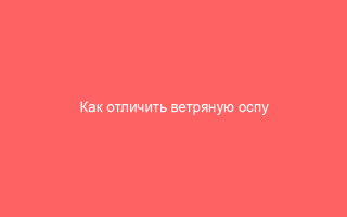 Как отличить ветряную оспу от аллергии