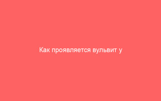 Как проявляется вульвит у девочек и чем его лечить