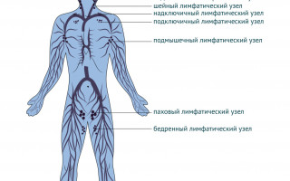 Увеличение лимфоузлов причины симптомы и лечение