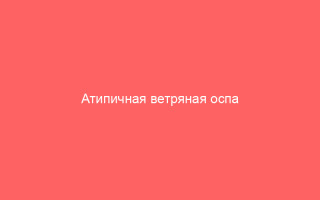 Атипичная ветряная оспа симптомы и способы лечения