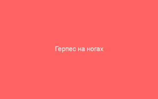 Герпес на ногах симптоматика этапы заболевания и процесс лечения