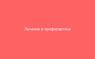 Лечение и профилактика герпеса у женщин
