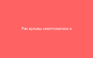 Рак вульвы симптоматика и методы лечения
