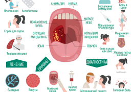 Фото и лечение фолликулярной ангины у взрослых эффективные методы