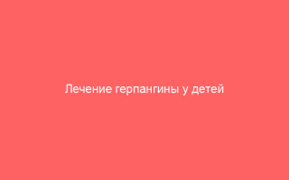 Лечение герпангины у детей всех возрастов правильные методы и рекомендации