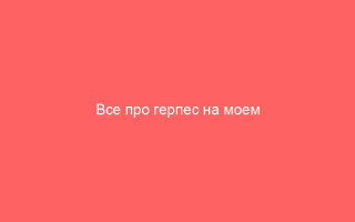 Все про герпес на моем сайте А Василевская Deutsch_2