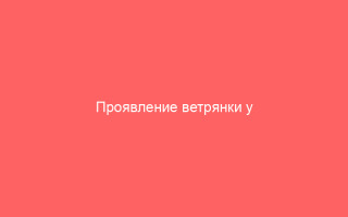 Проявление ветрянки у взрослых и детей