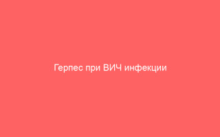 Герпес при ВИЧ инфекции лечение и профилактика – полезная информация