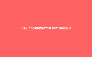 Как проявляется ветрянка у детей до года