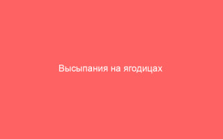 Высыпания на ягодицах  причины и способы лечения