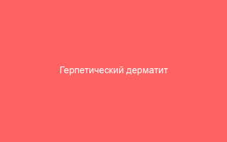Герпетический дерматит виды и эффективные методы лечения болезни