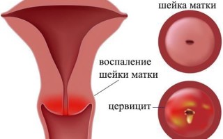 Слизистая гиперемирована причины симптомы и лечение