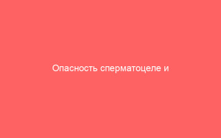Опасность сперматоцеле и способы его лечения