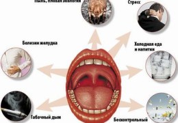 Постоянно болит горло причины и лечение частых болей у взрослых