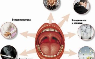 Постоянно болит горло причины и лечение частых болей у взрослых