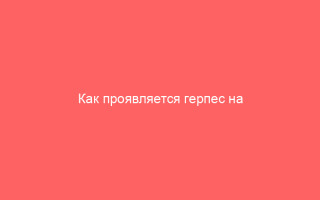 Как проявляется герпес на голове и чем он опасен