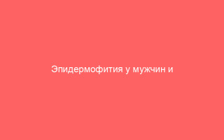 Эпидермофития у мужчин и женщин симптоматика и лечение