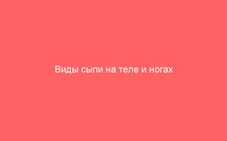 Виды сыпи на теле и ногах как определить и лечить