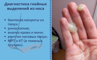 Эффективные методы и средства лечения вонючих гнойных соплей с запахом гноя