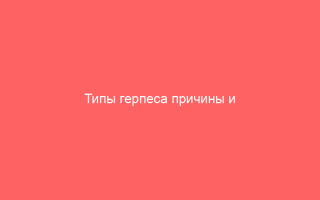 Типы герпеса причины и симптомы в зависимости от разновидности вируса