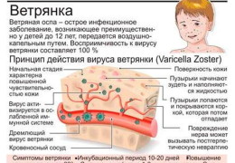 Фенистил при ветрянке (гель, капли): можно ли мазать детям