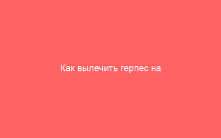 Как вылечить герпес на копчике