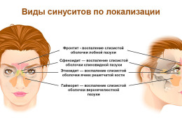 Температура при гайморите какая может быть и сколько держится