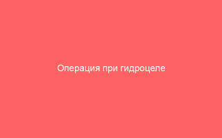 Операция при гидроцеле подготовка и проведение