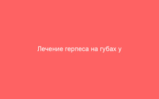 Лечение герпеса на губах у детей