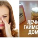 Народные рецепты от гайморита лечение в домашних условиях