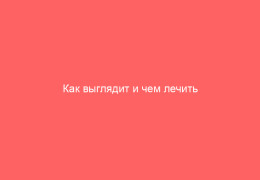 Как выглядит и чем лечить вульвовагинит у женщин