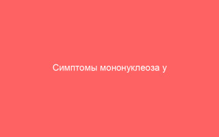 Симптомы мононуклеоза у взрослых