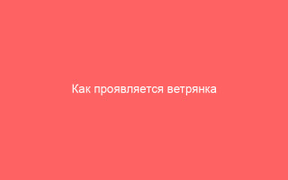 Как проявляется ветрянка на глазах