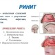 Ринит у взрослых симптомы причины и эффективное лечение насморка